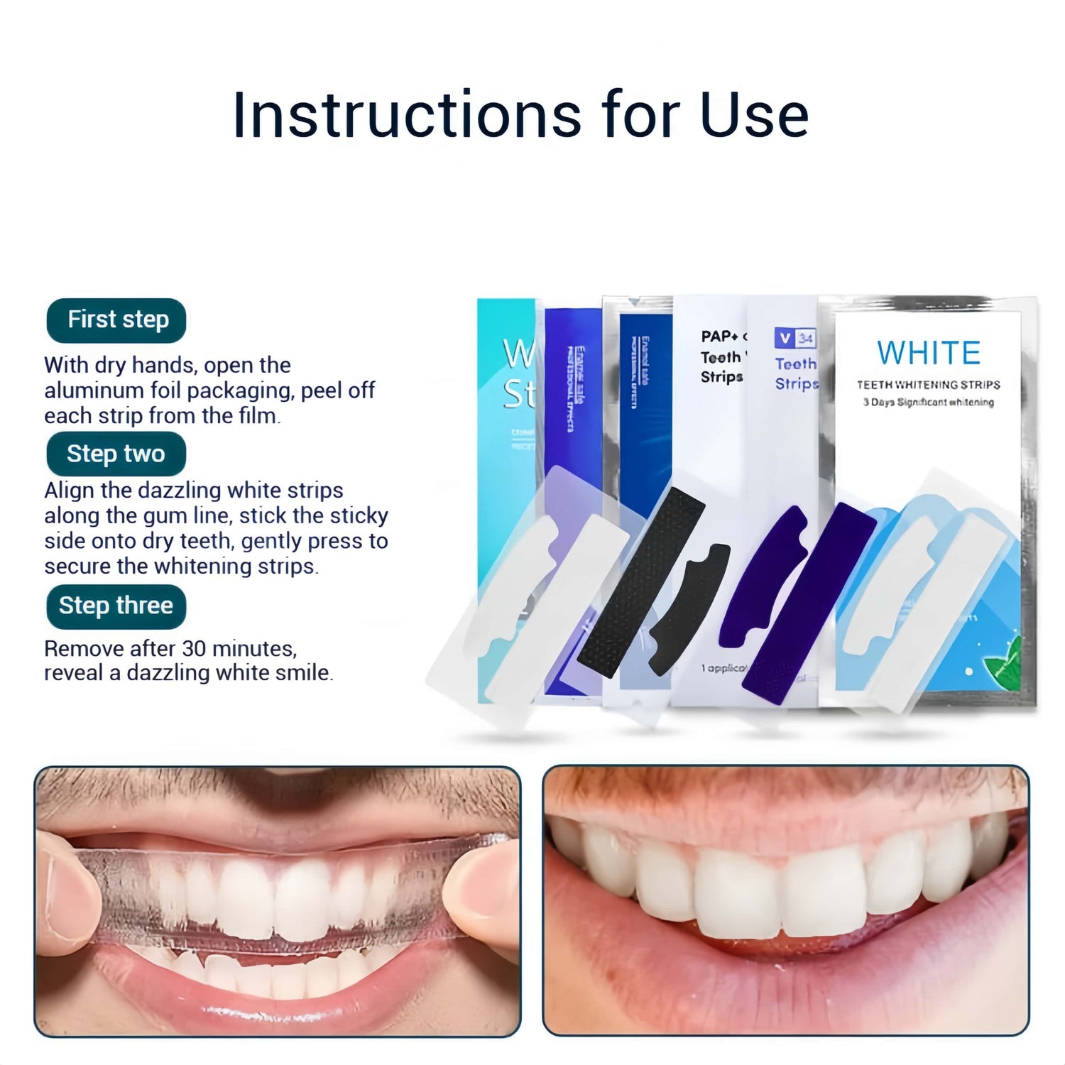 Orateeth Teeth Whitening Strips – Fast-Acting Formula (14-Pack)
