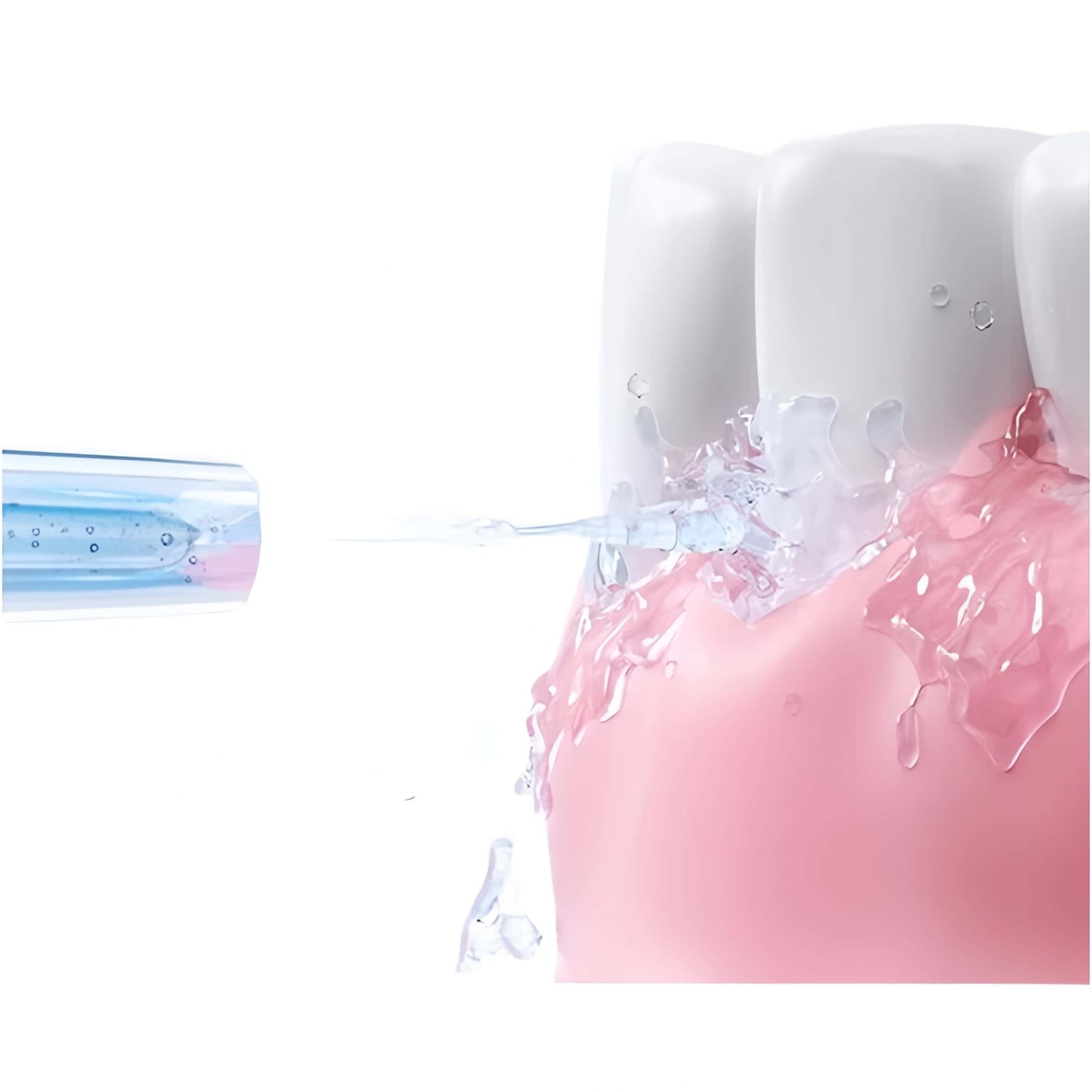 Orateeth Family Water Flosser Replacement Tips
