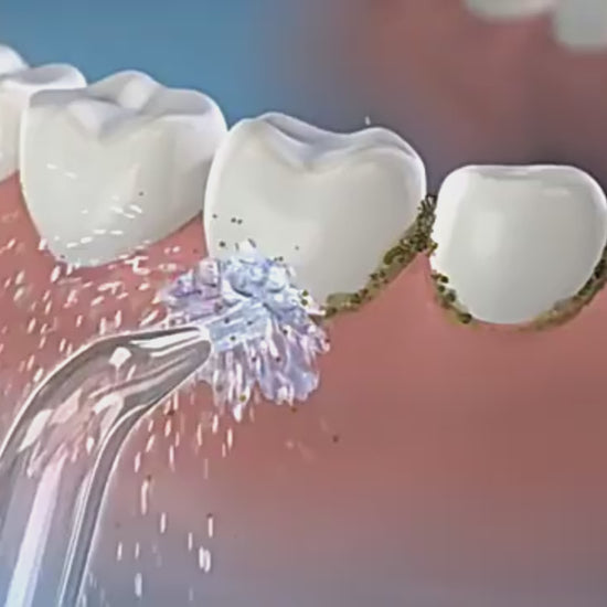 Orateeth Pocket Water Flosser Replacement Tips