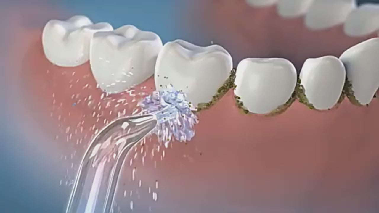 Orateeth Pocket Water Flosser Replacement Tips
